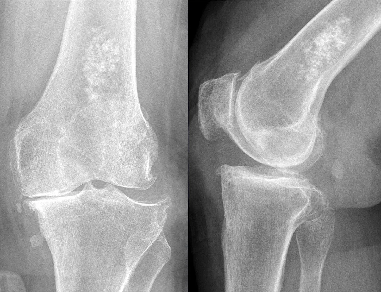 Bone & joint disease radiograph for self-assessment