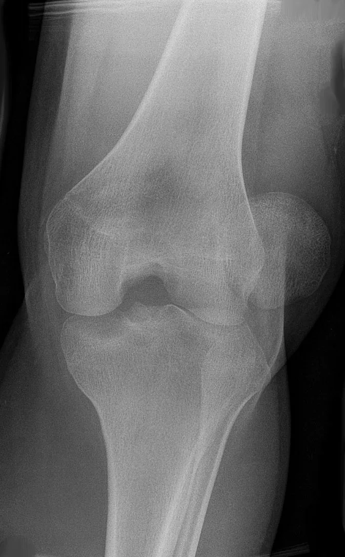 Lower limb radiograph for self-assessment