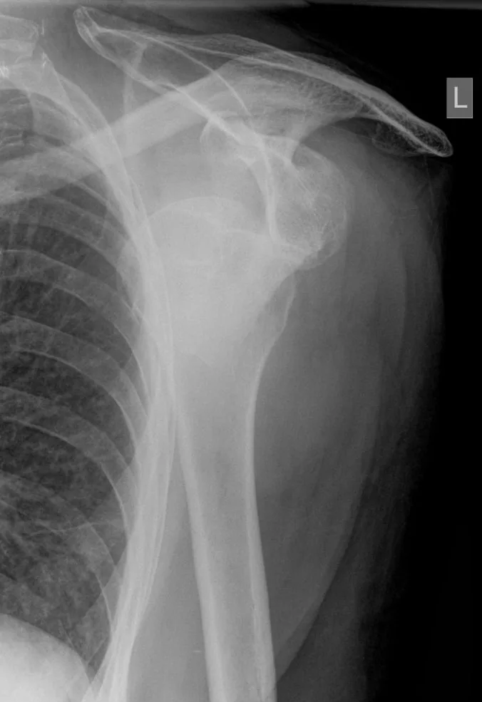 Upper limb radiograph for self-assessment