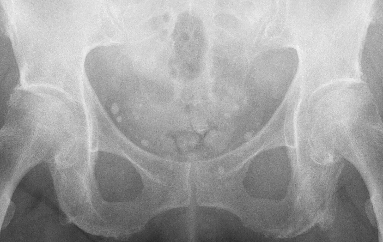 Abdomen radiograph for self-assessment