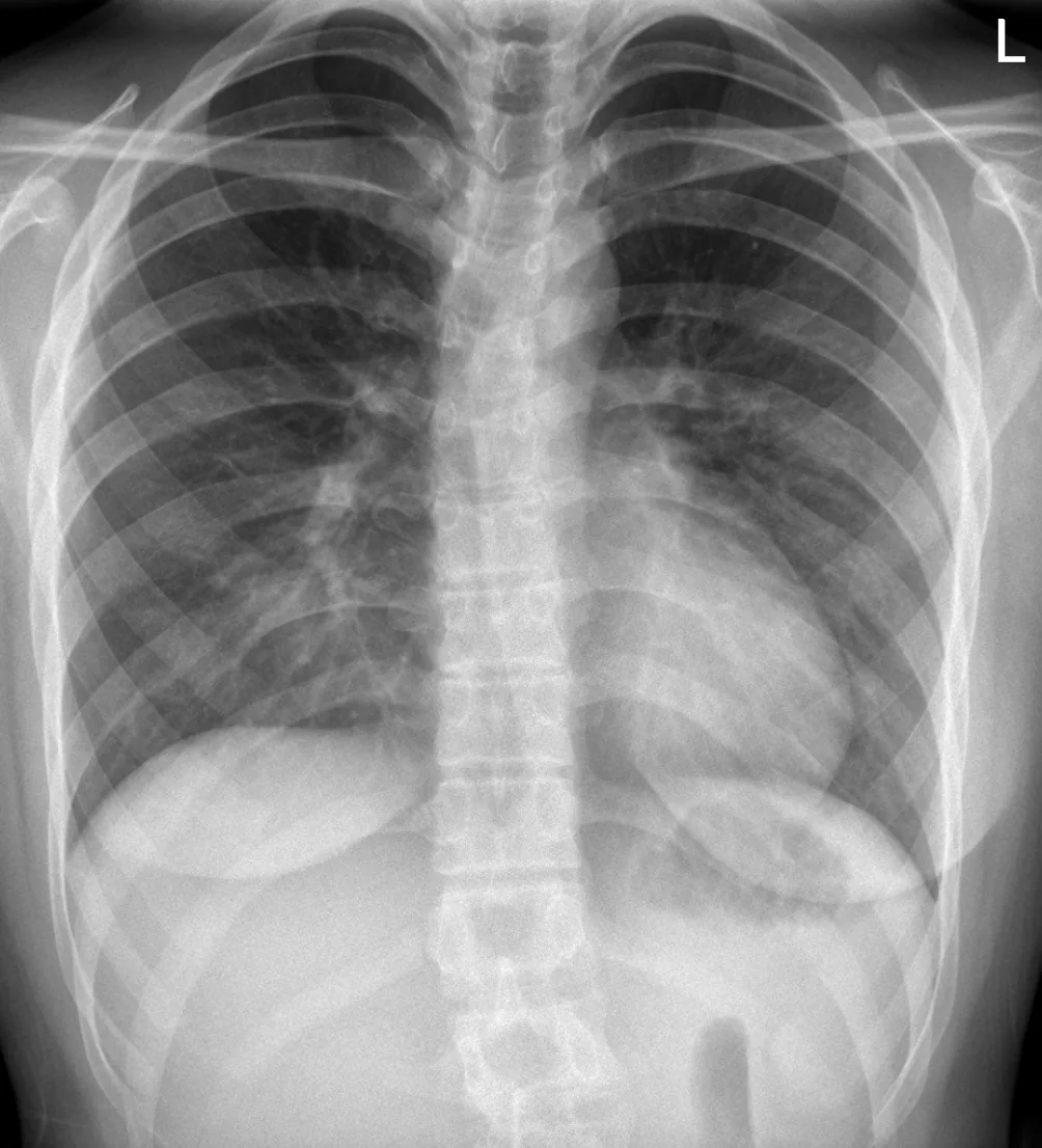 Chest radiograph for self-assessment