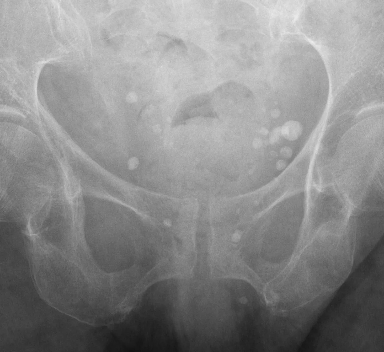 Abdomen radiograph for self-assessment