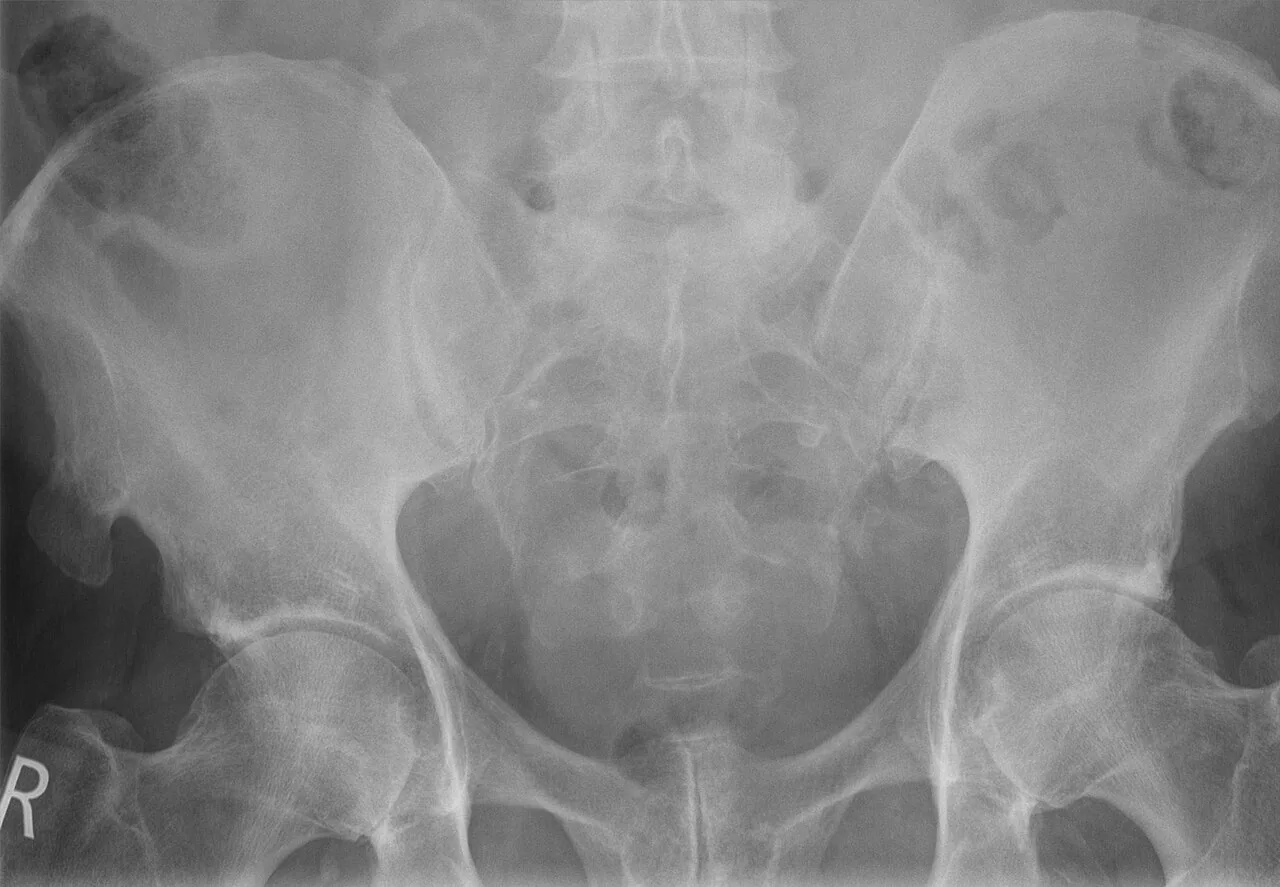 Bone & joint disease radiograph for self-assessment
