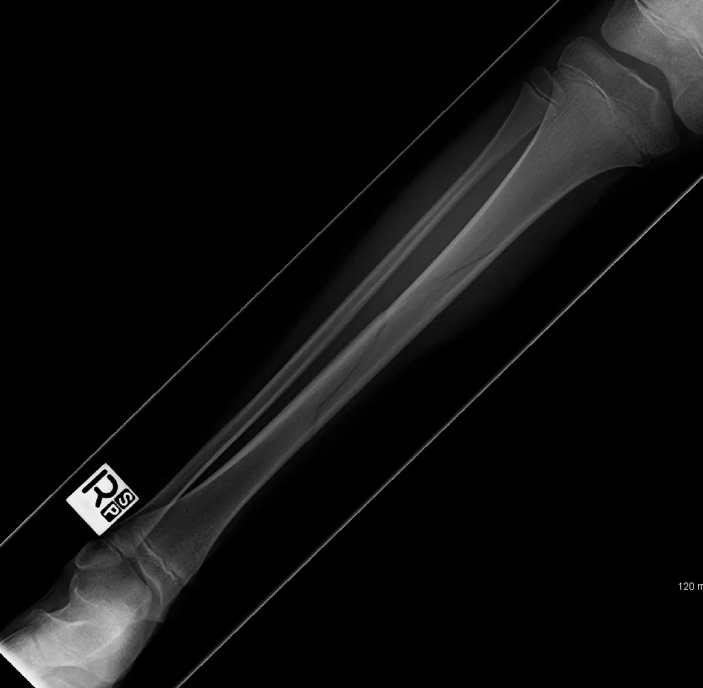Lower limb radiograph for self-assessment