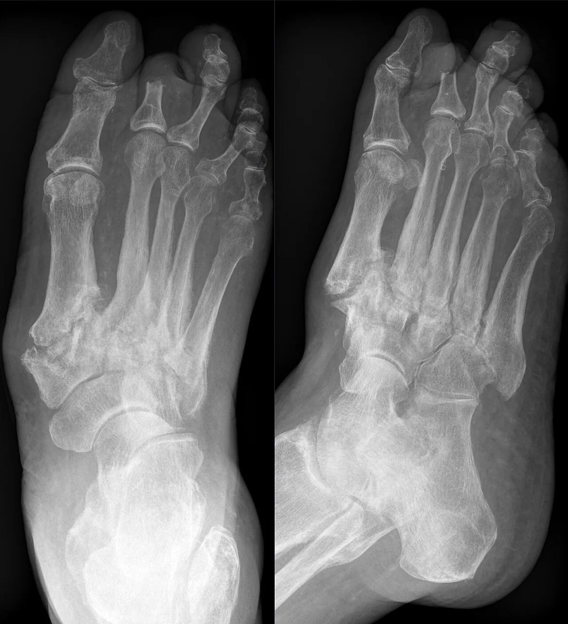 Bone & joint disease radiograph for self-assessment