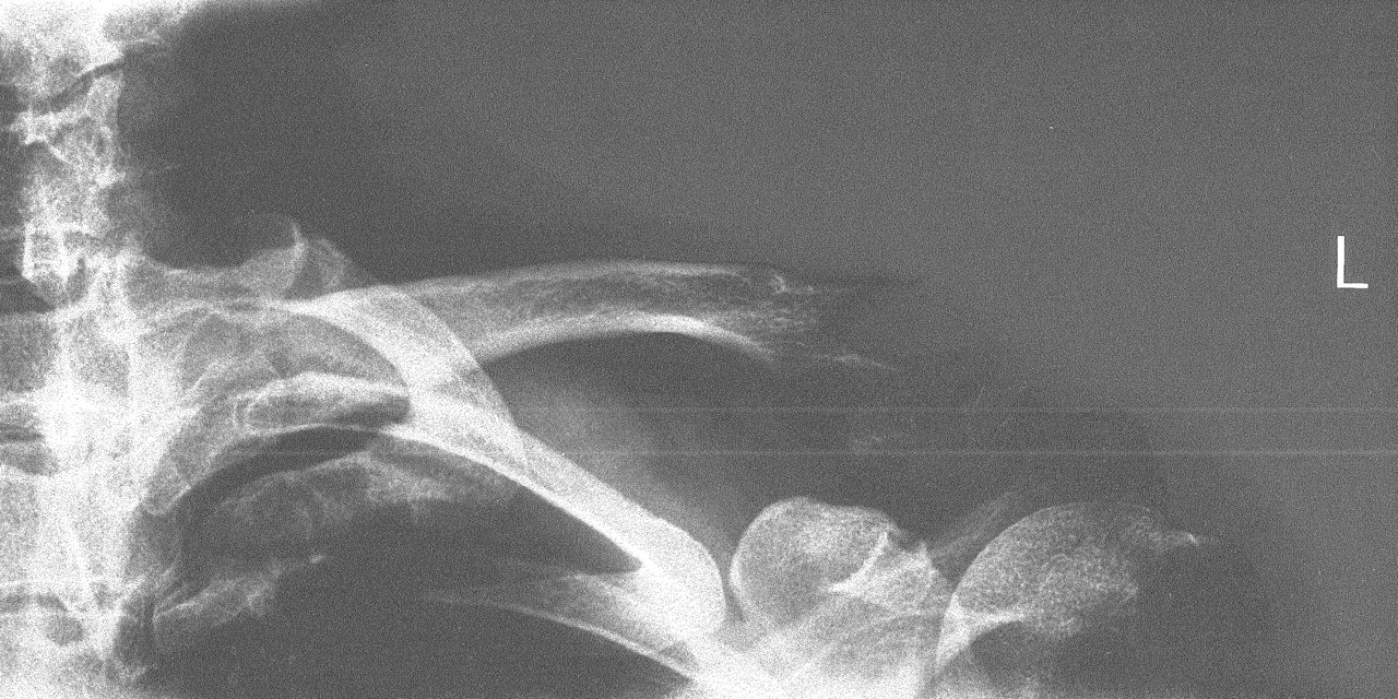 Upper limb radiograph for self-assessment