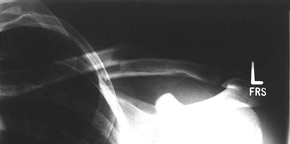 Upper limb radiograph for self-assessment
