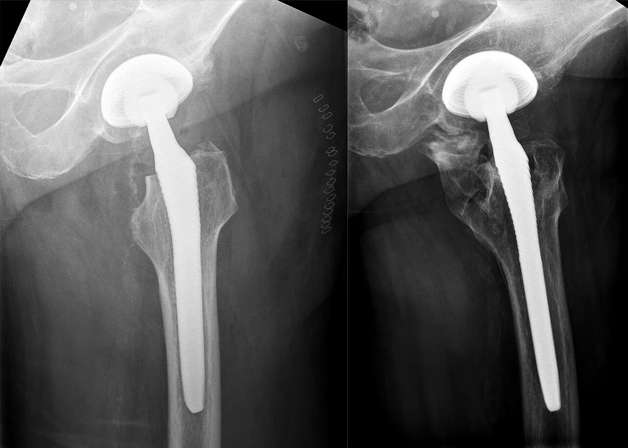 Bone & joint disease radiograph for self-assessment