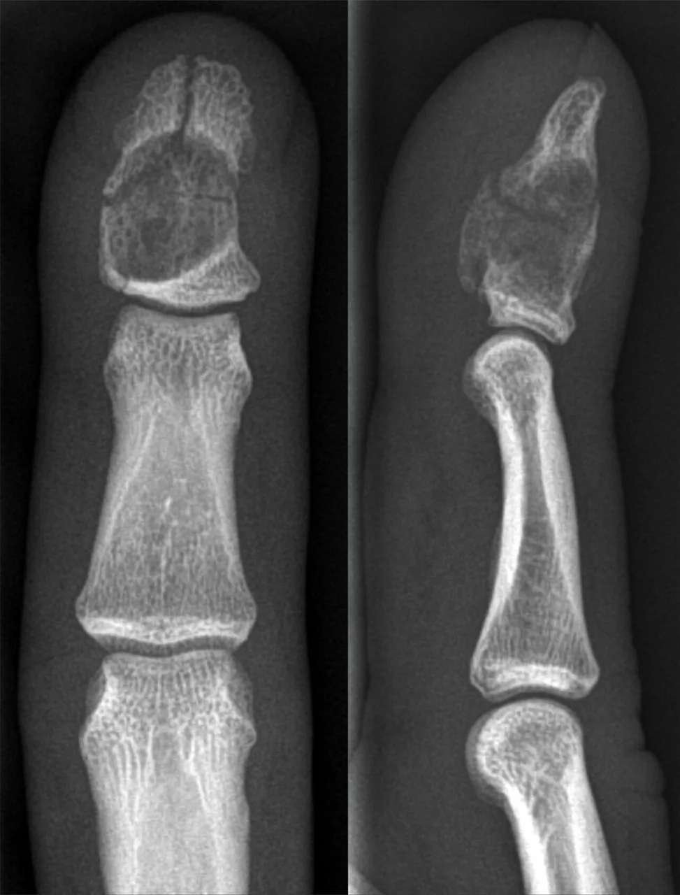 Bone & joint disease radiograph for self-assessment