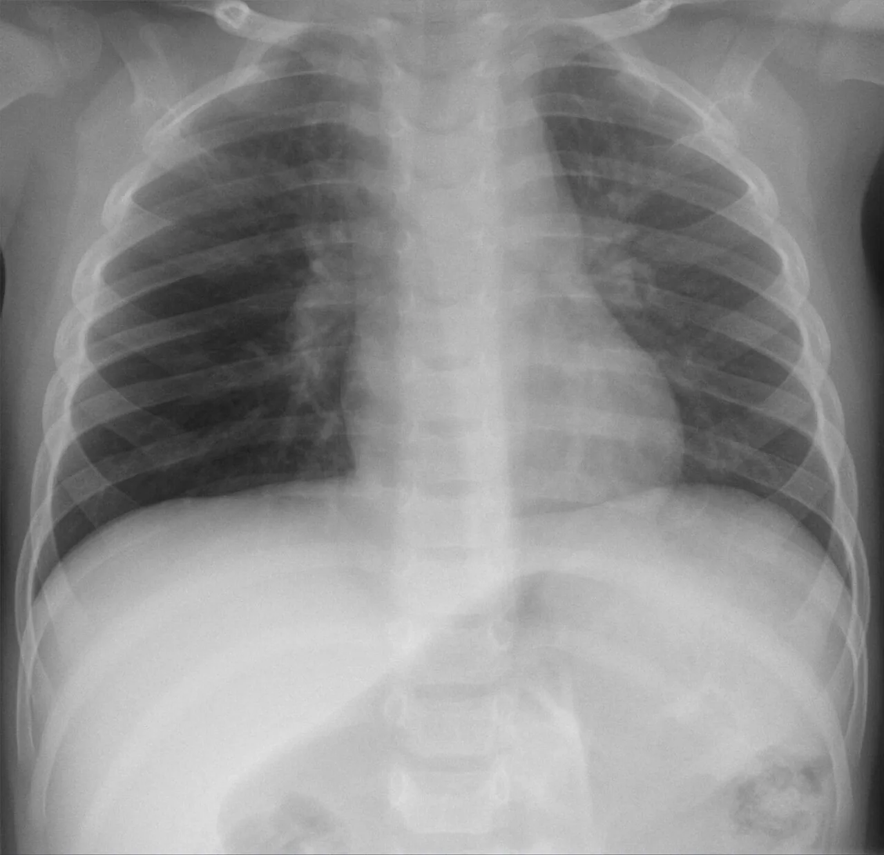 Paediatric radiograph for self-assessment