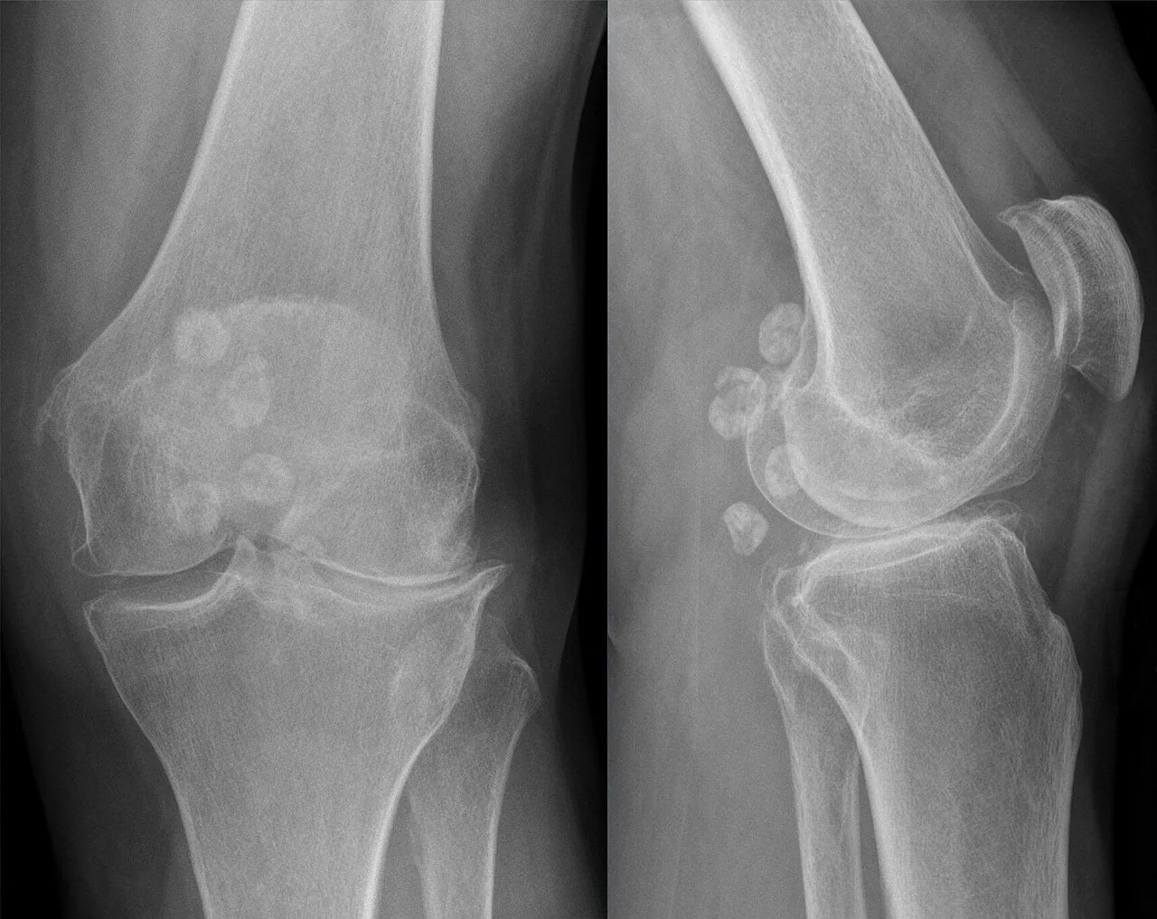 Bone & joint disease radiograph for self-assessment