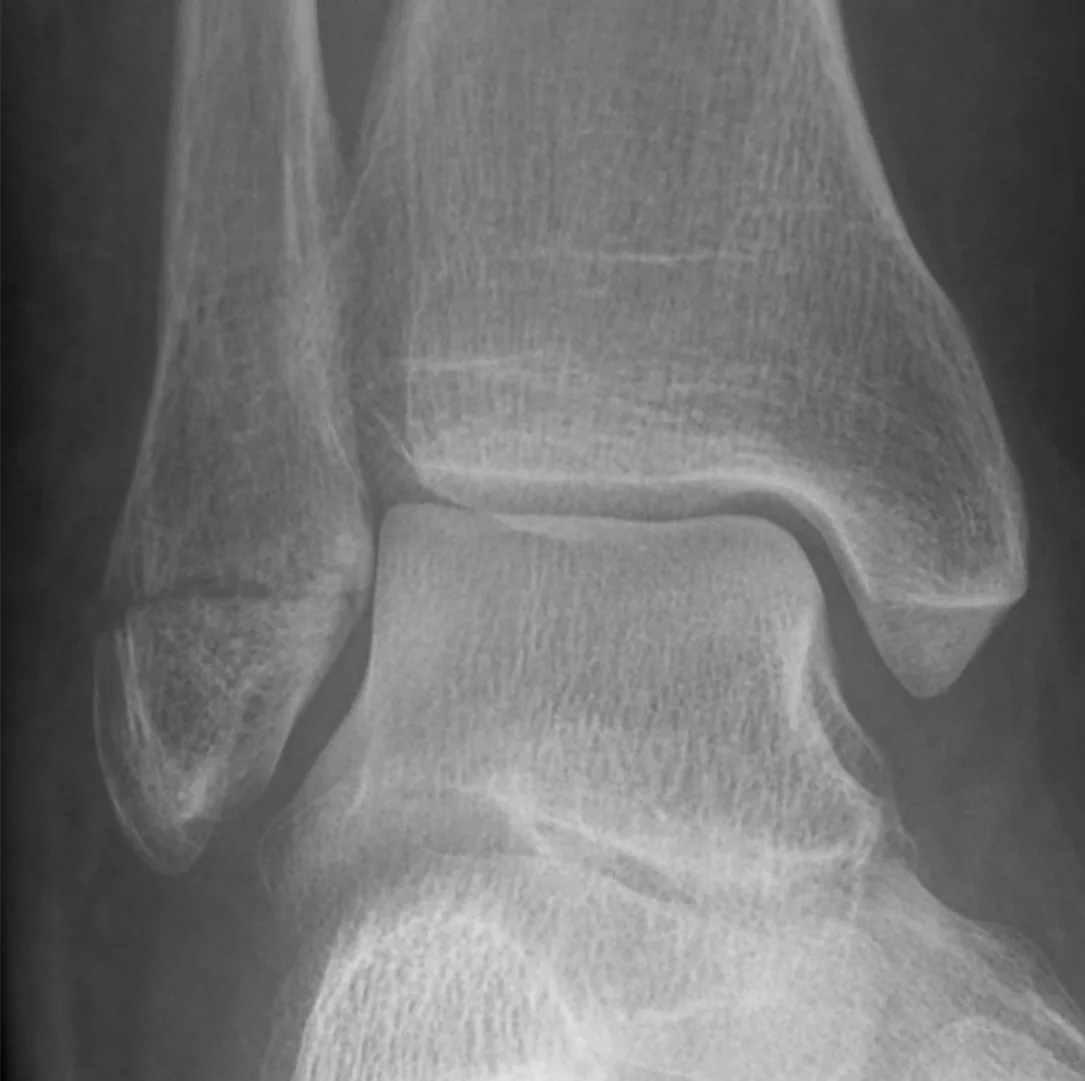 Lower limb radiograph for self-assessment