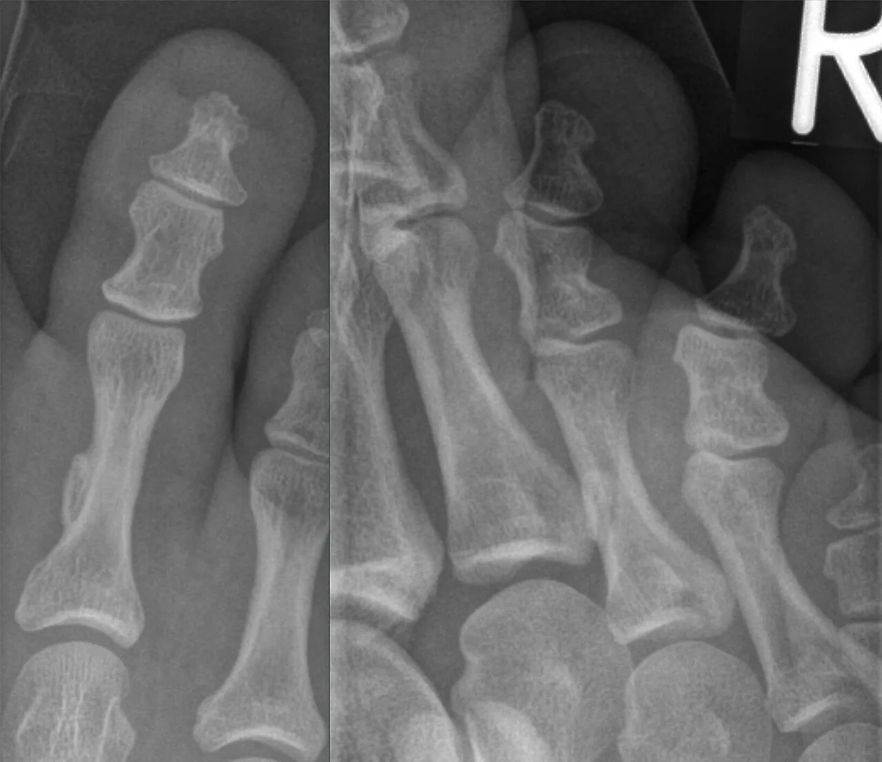 Bone & joint disease radiograph for self-assessment