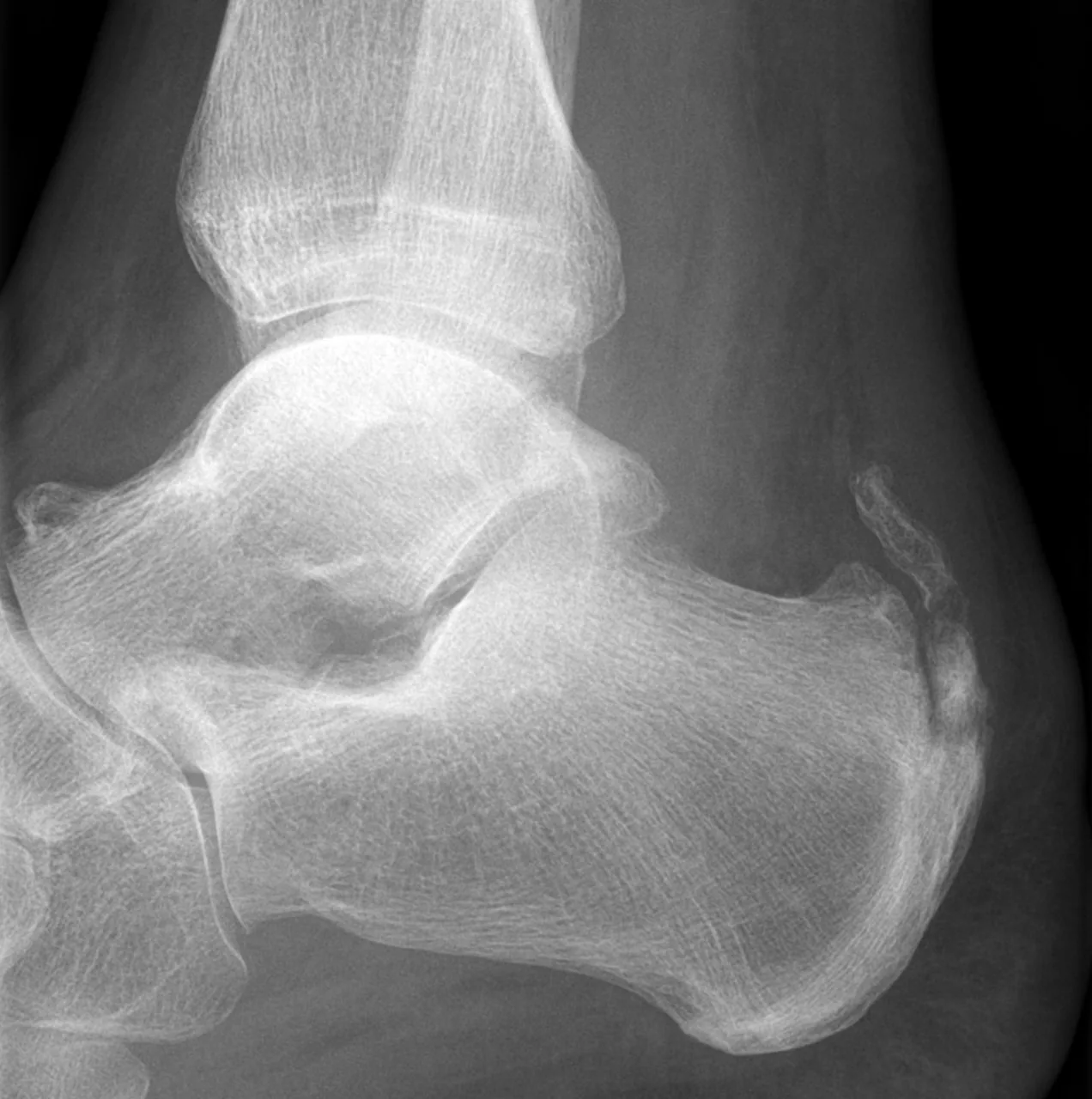 Lower limb radiograph for self-assessment