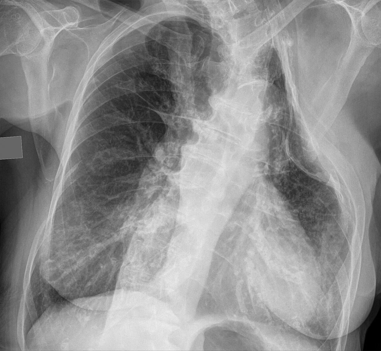 Chest radiograph for self-assessment