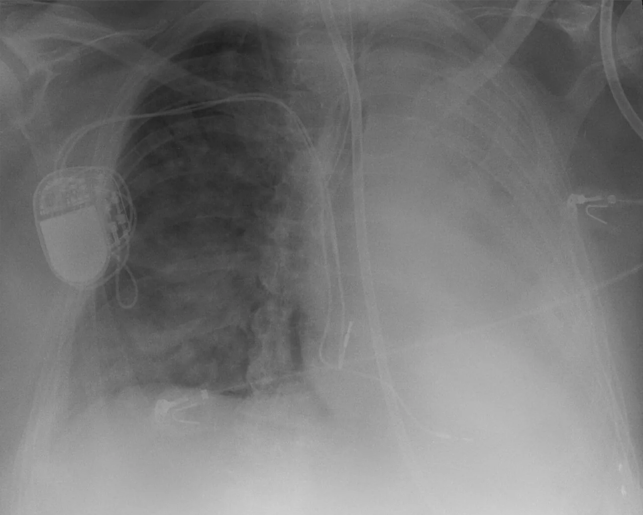 Lines & tubes radiograph for self-assessment