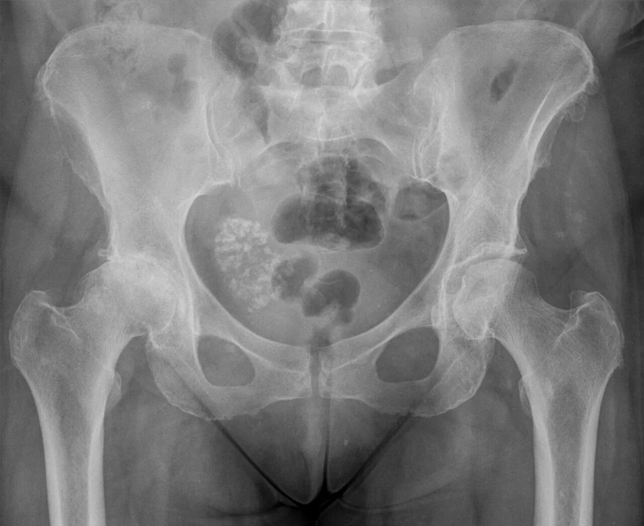 Abdomen radiograph for self-assessment