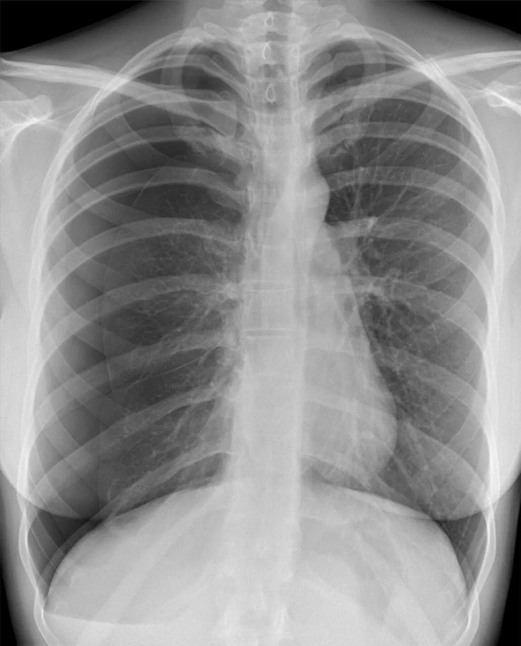 Chest radiograph for self-assessment