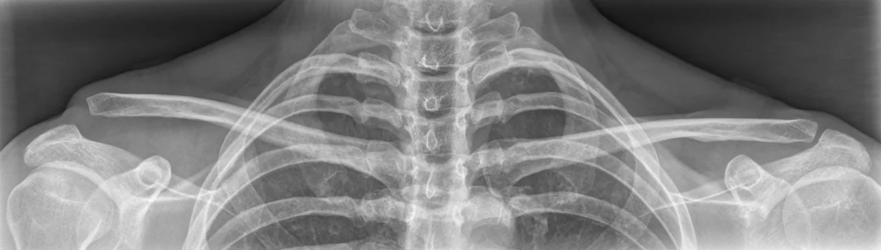 Upper limb radiograph for self-assessment
