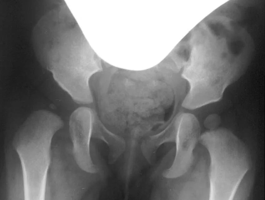 Paediatric radiograph for self-assessment