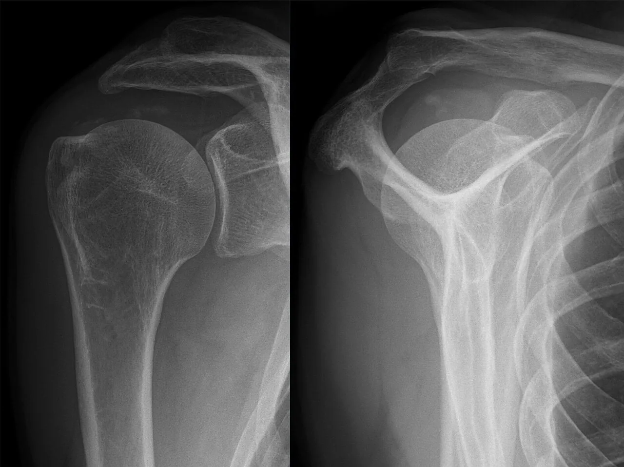Upper limb radiograph for self-assessment