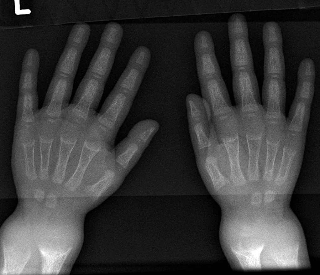 Paediatric radiograph for self-assessment