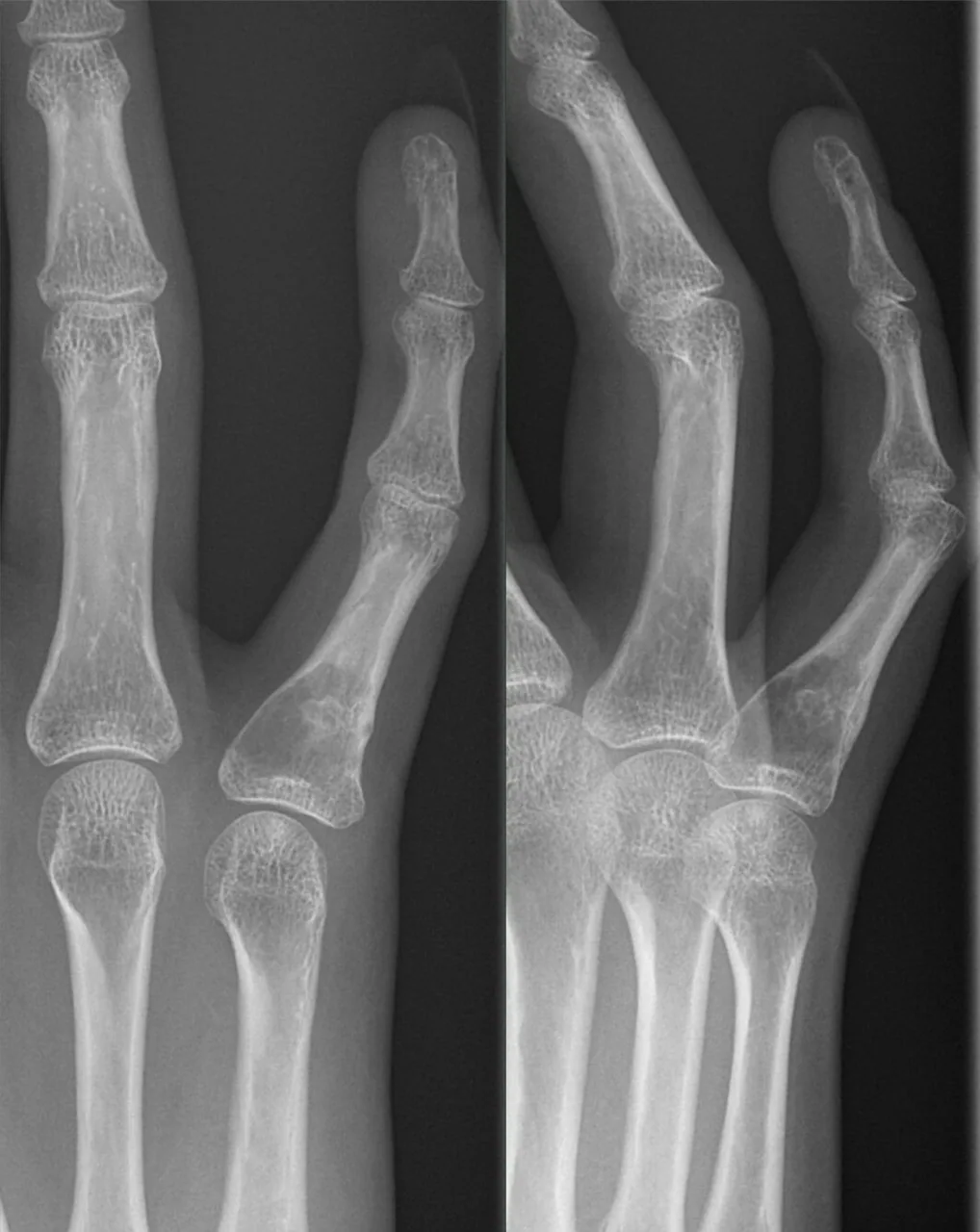Bone & joint disease radiograph for self-assessment