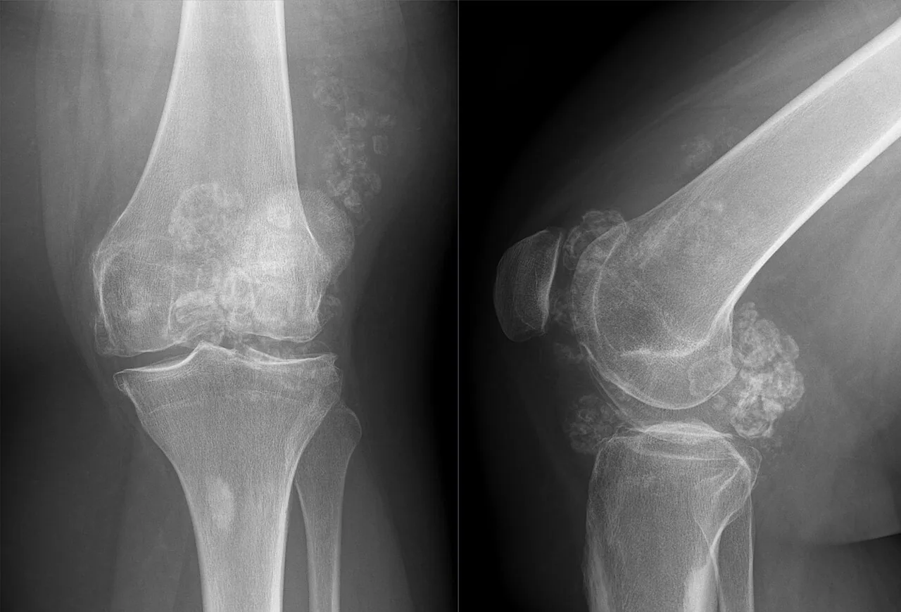 Bone & joint disease radiograph for self-assessment
