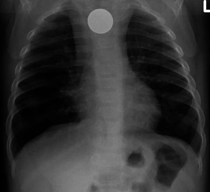 Paediatric radiograph for self-assessment