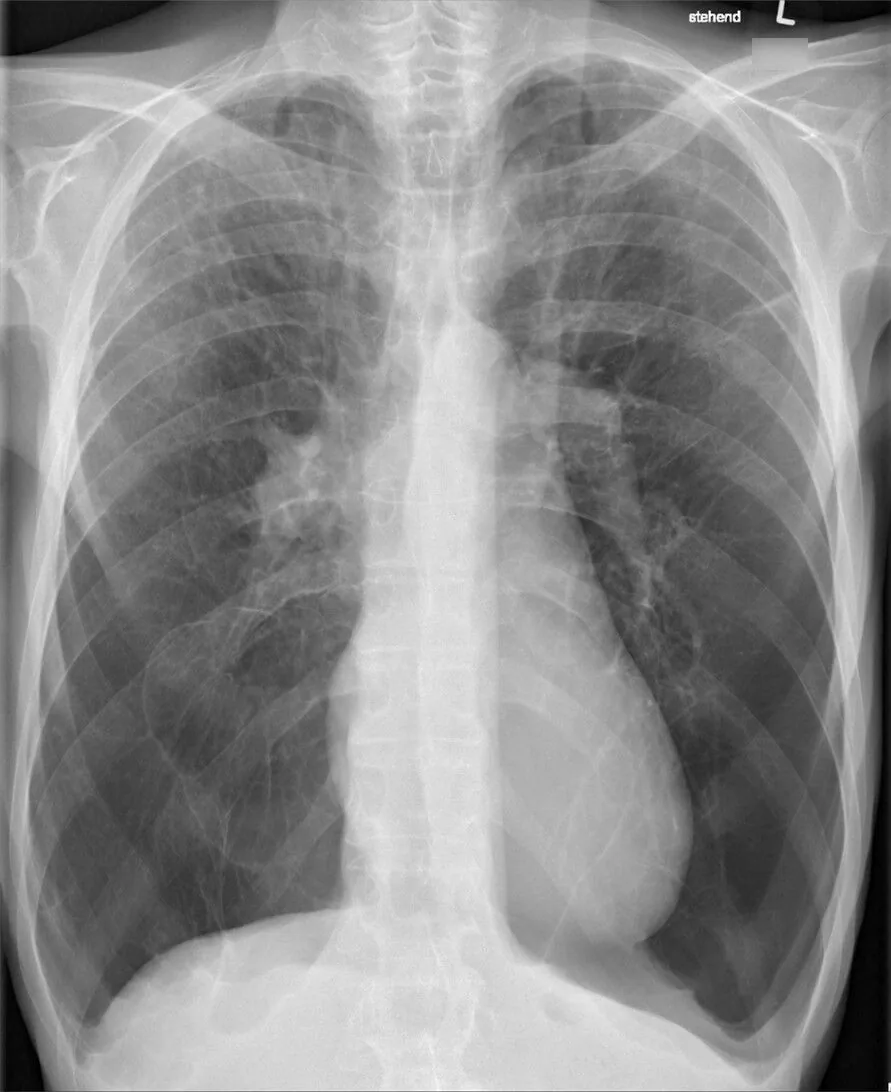 Chest radiograph for self-assessment