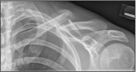 Upper limb radiograph for self-assessment