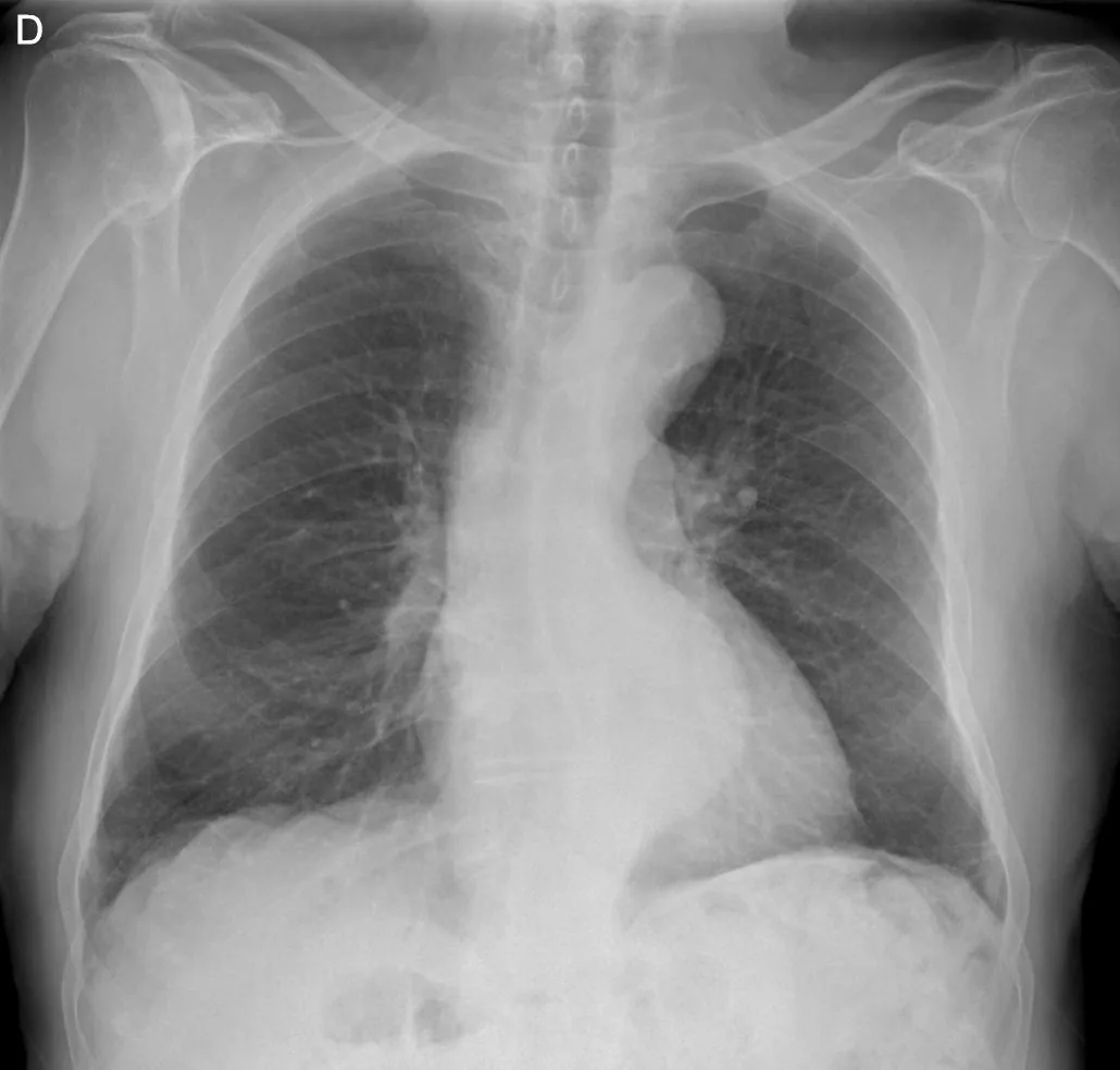 Chest radiograph for self-assessment