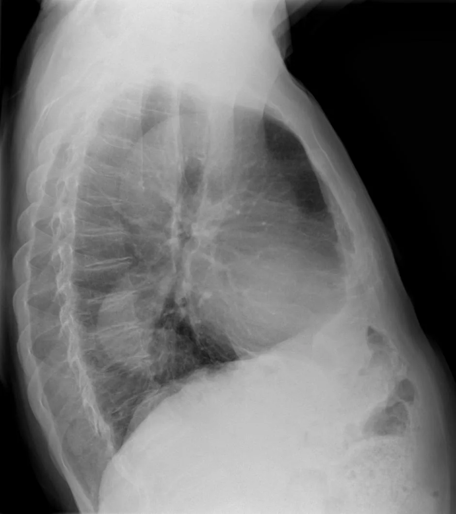 Chest radiograph for self-assessment