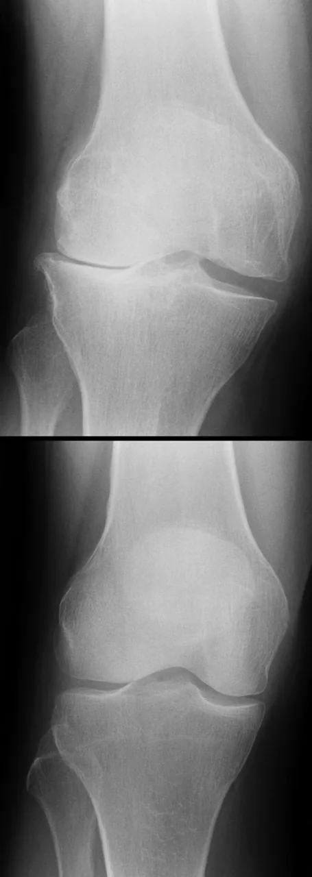 Bone & joint disease radiograph for self-assessment
