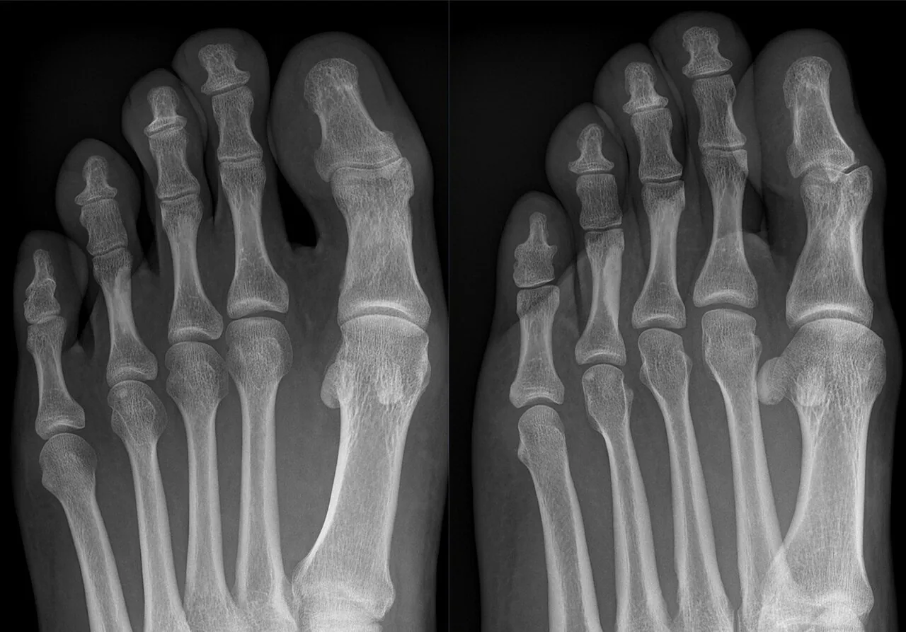 Bone & joint disease radiograph for self-assessment