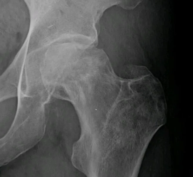 Bone & joint disease radiograph for self-assessment