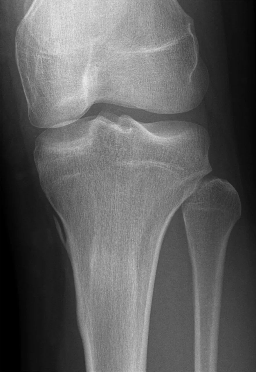 Lower limb radiograph for self-assessment