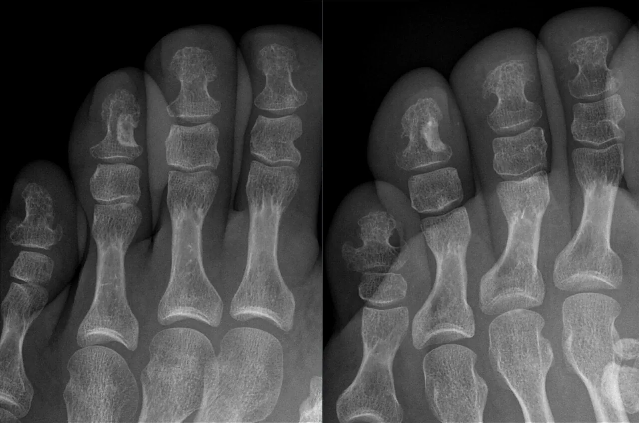 Bone & joint disease radiograph for self-assessment