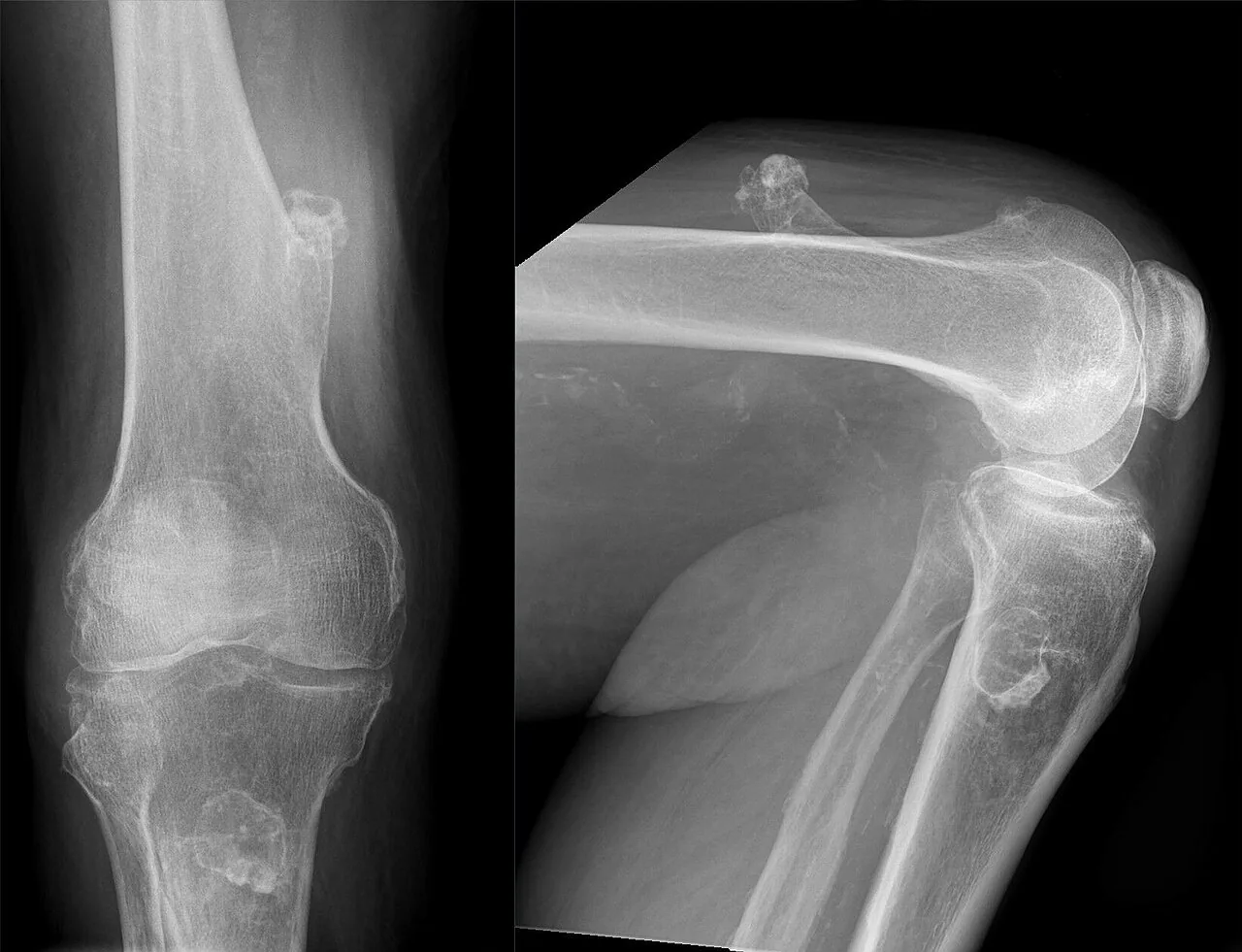 Bone & joint disease radiograph for self-assessment