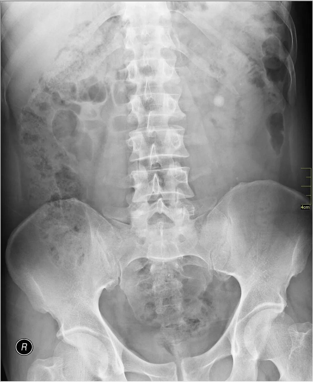 Abdomen radiograph for self-assessment