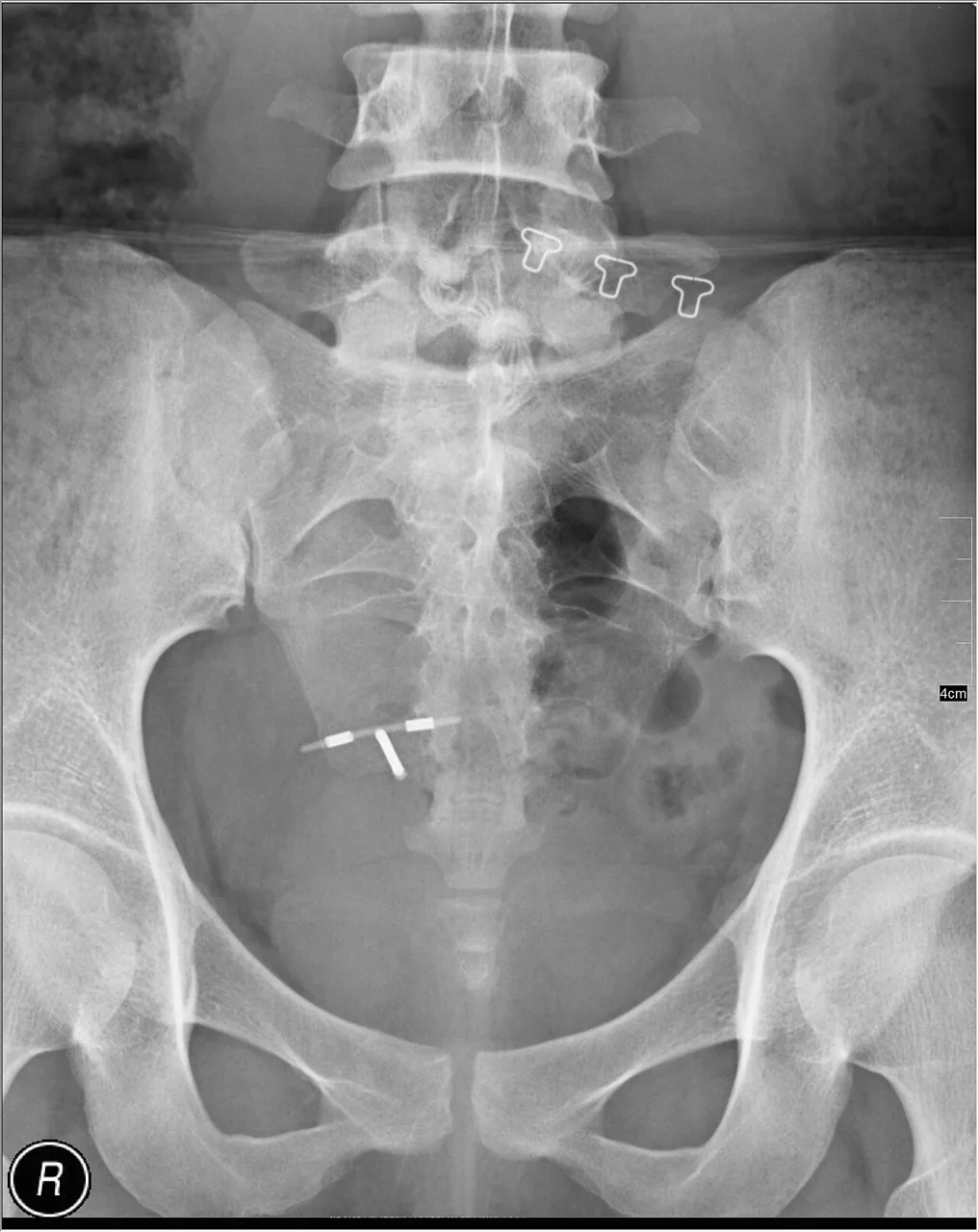 Abdomen radiograph for self-assessment