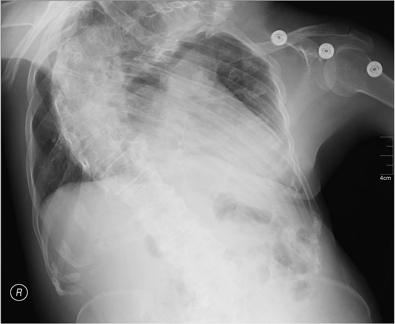 Spine radiograph for self-assessment