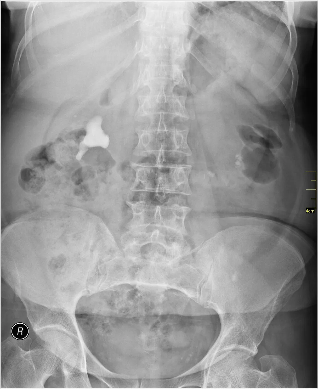 Abdomen radiograph for self-assessment