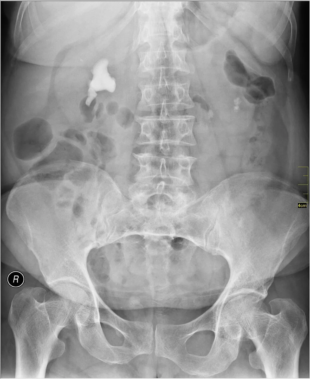 Abdomen radiograph for self-assessment