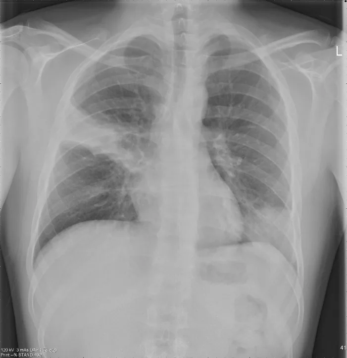 Chest radiograph for self-assessment