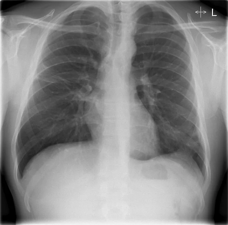 Chest radiograph for self-assessment