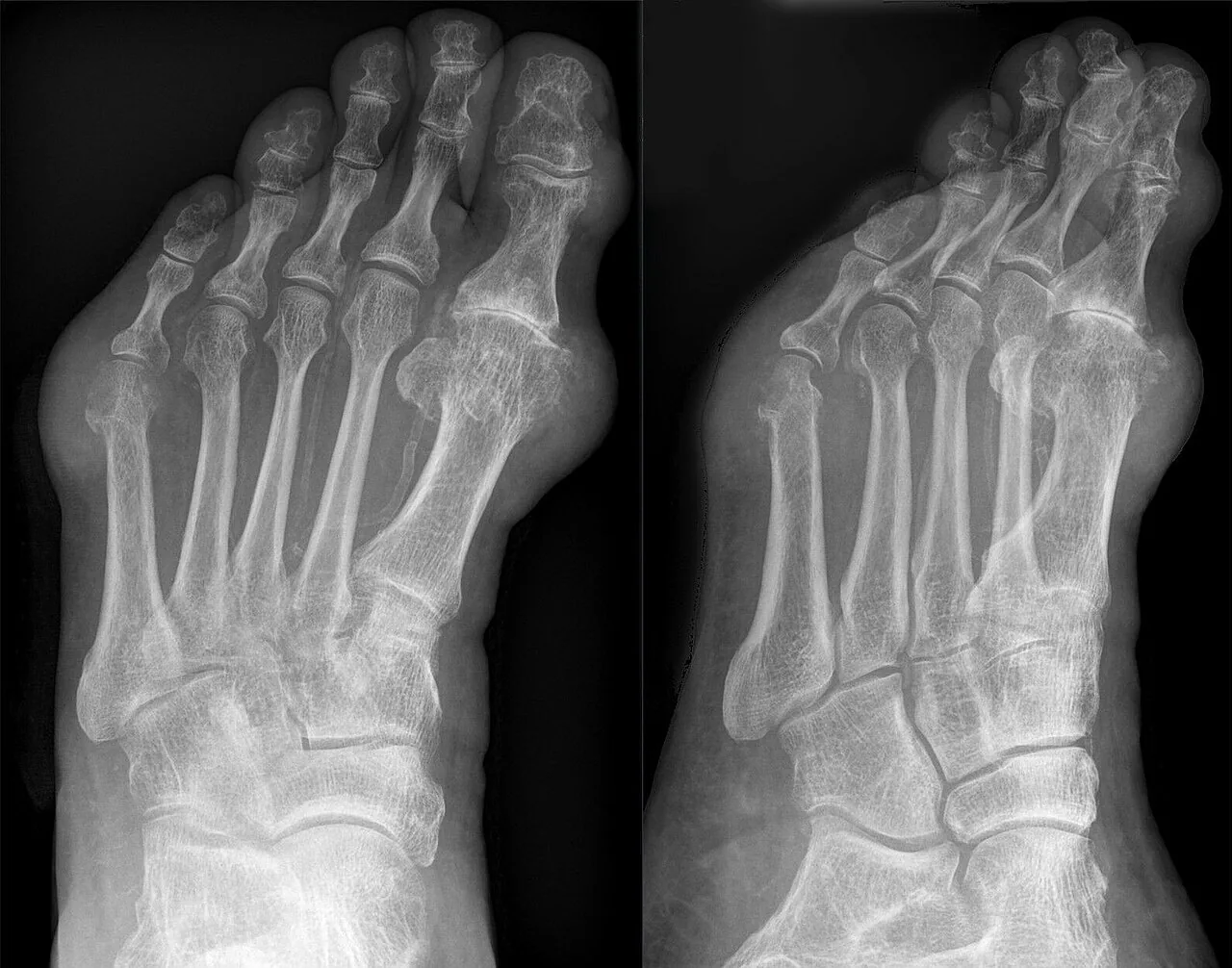 Bone & joint disease radiograph for self-assessment