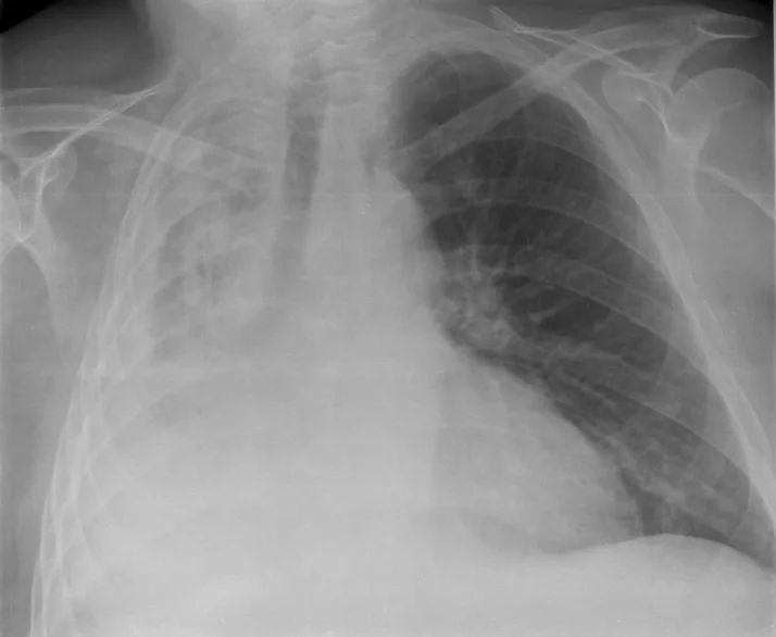 Chest radiograph for self-assessment