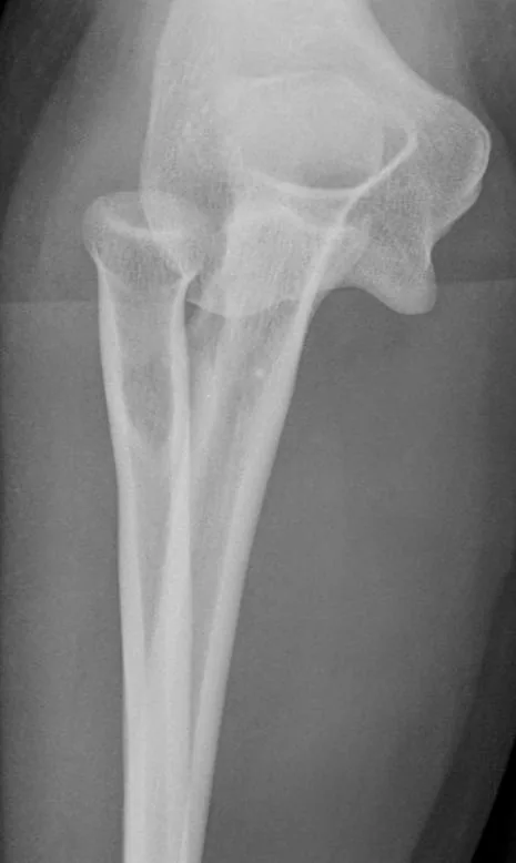 Upper limb radiograph for self-assessment