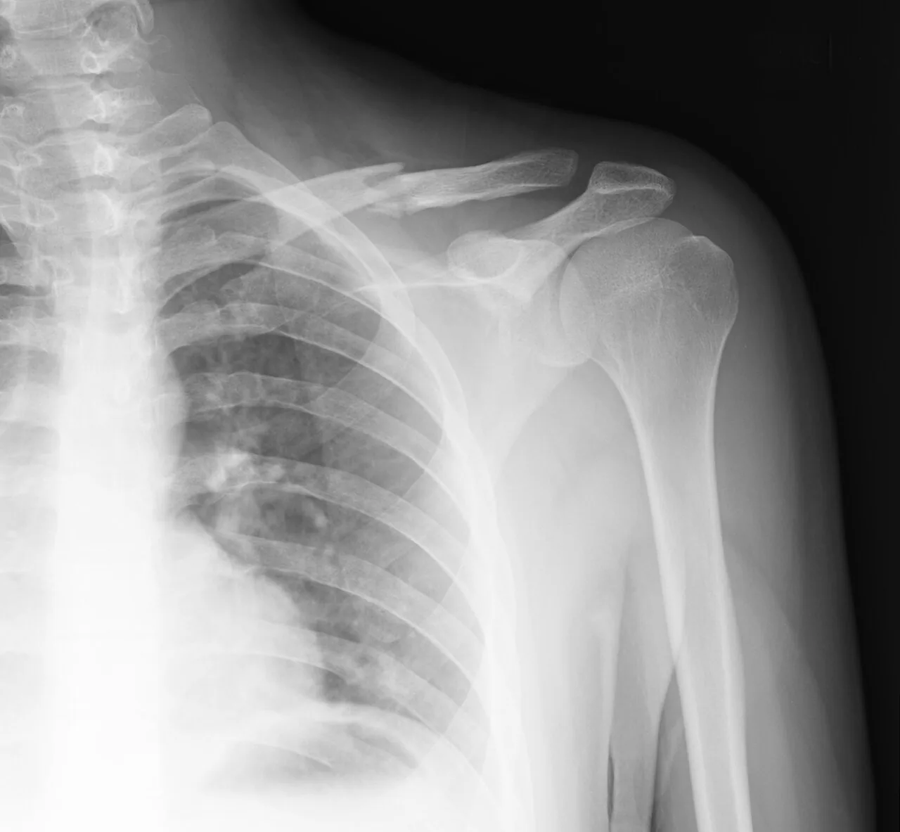 Upper limb radiograph for self-assessment